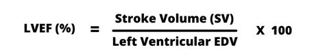 ejection fraction calculation formula